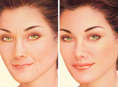filler injections,filler injections cost,filler injections near me,filler injections for face,filler injections in cheeks,filler injections for wrinkles,filler injections for dark circles,filler injections for acne scars